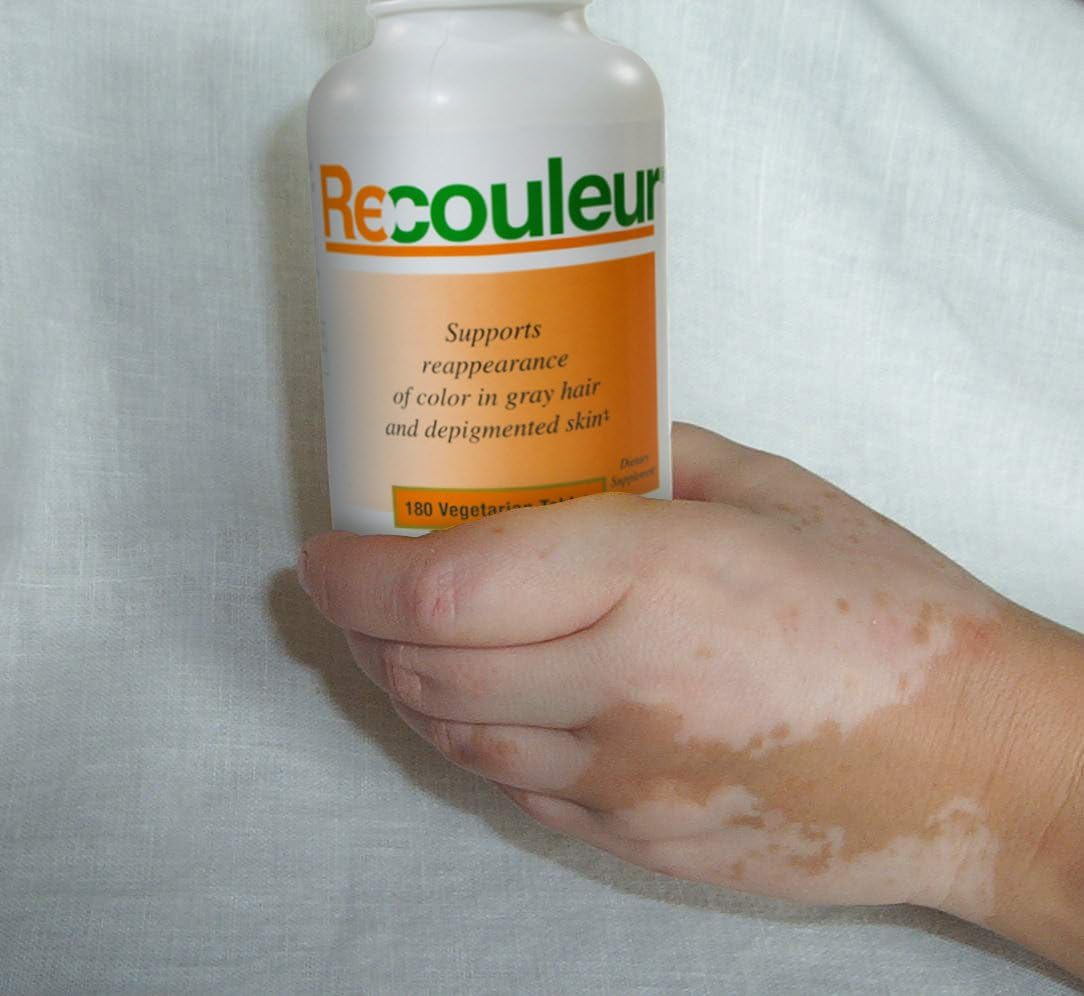 Recouleur Vitiligo Supplement: Vitamin and Mineral Blend for Skin Pigmentation Support - 6 Month Supply