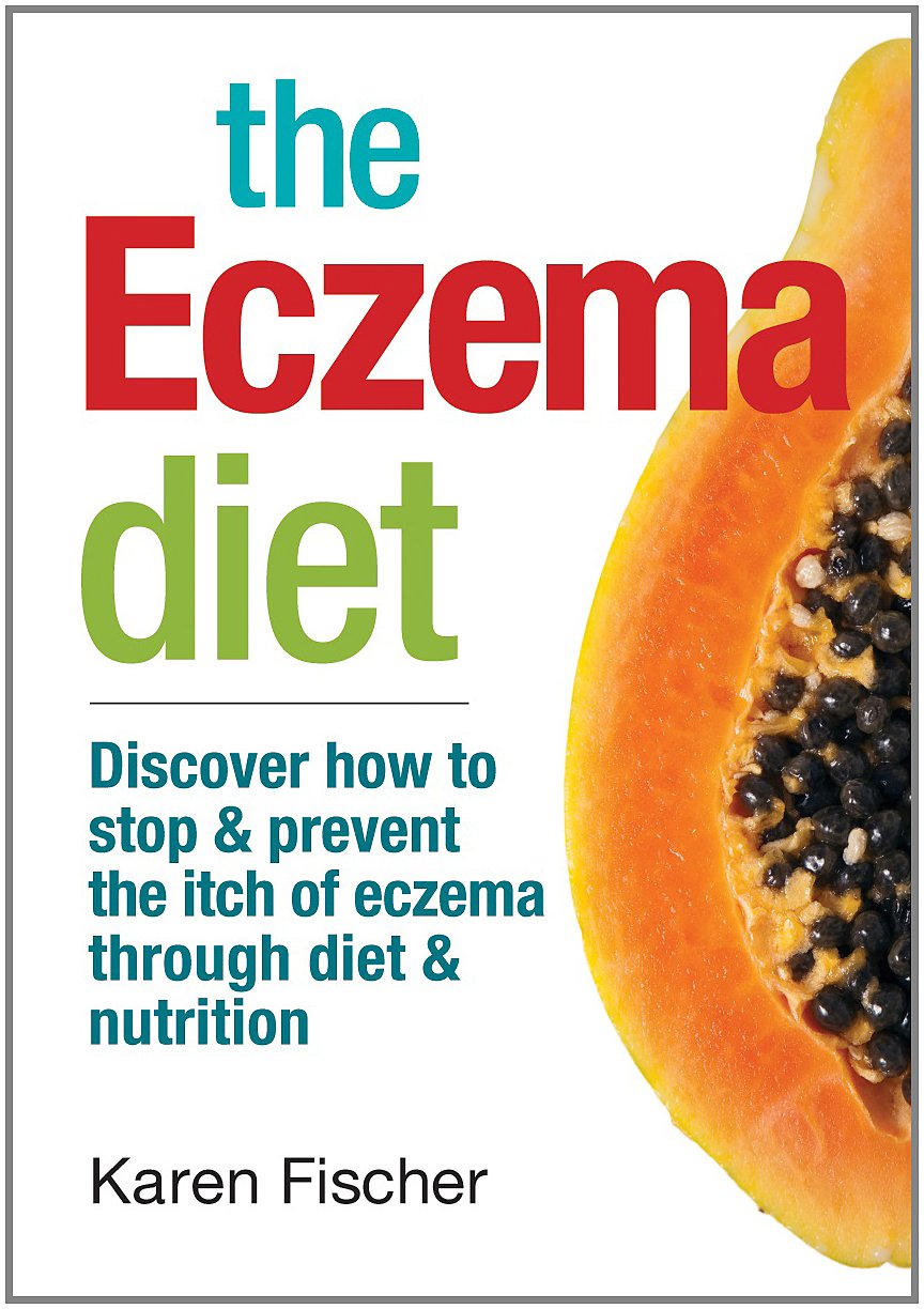 The Eczema Diet: Discover How to Stop and Prevent the Itch of Eczema Through Diet and Nutrition