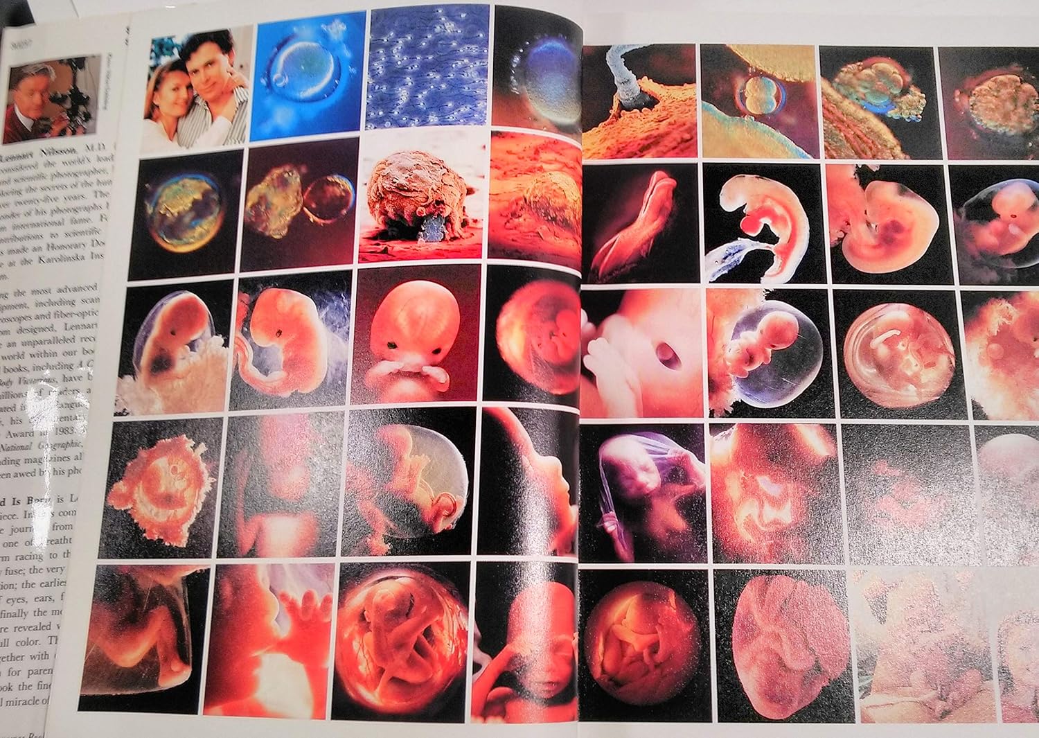 A Child Is Born by Lennart Nilsson